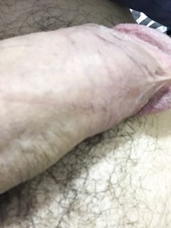 Cercasi bocca di donna...