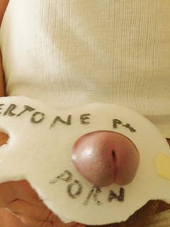 El caxxo xè el caxxo