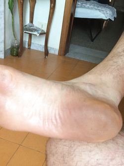 Piedi Parte 4