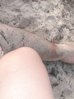 Sono il suo zerbino!