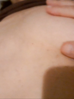 Mia moglie viene visitata da un medico - prima parte